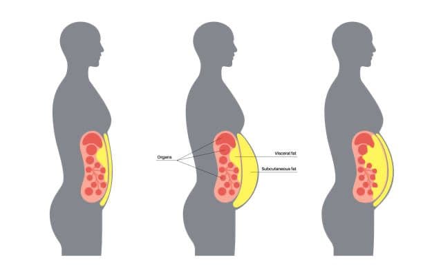 Weight Management Programme